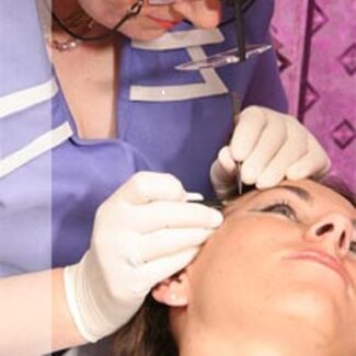 electrolysis-tracy-st-louis-mo