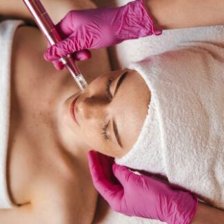 microneedling-face