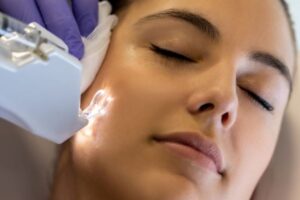 reduce-microneedling-pain-with-topical-anesthetics