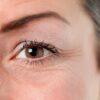 reduce-dermal-wrinkles-around-eye